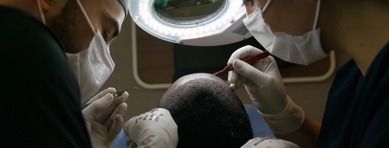 زراعة الشعر الإفريقي: ما الذي يجعل الشعر ذا الملمس الإفريقي مختلفًا