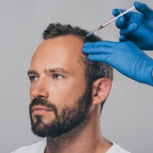 Stem cell treatment for hair loss: revolution, or marketing ahead of the science?