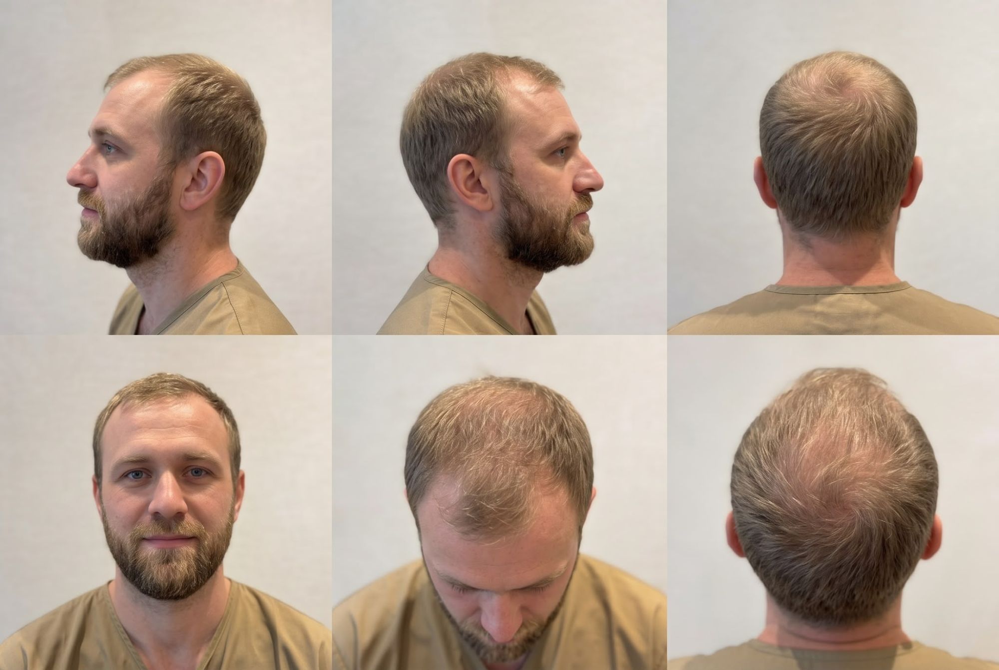 Billeder vi beder om: forfra, fra begge sider, bagfra og oppefra