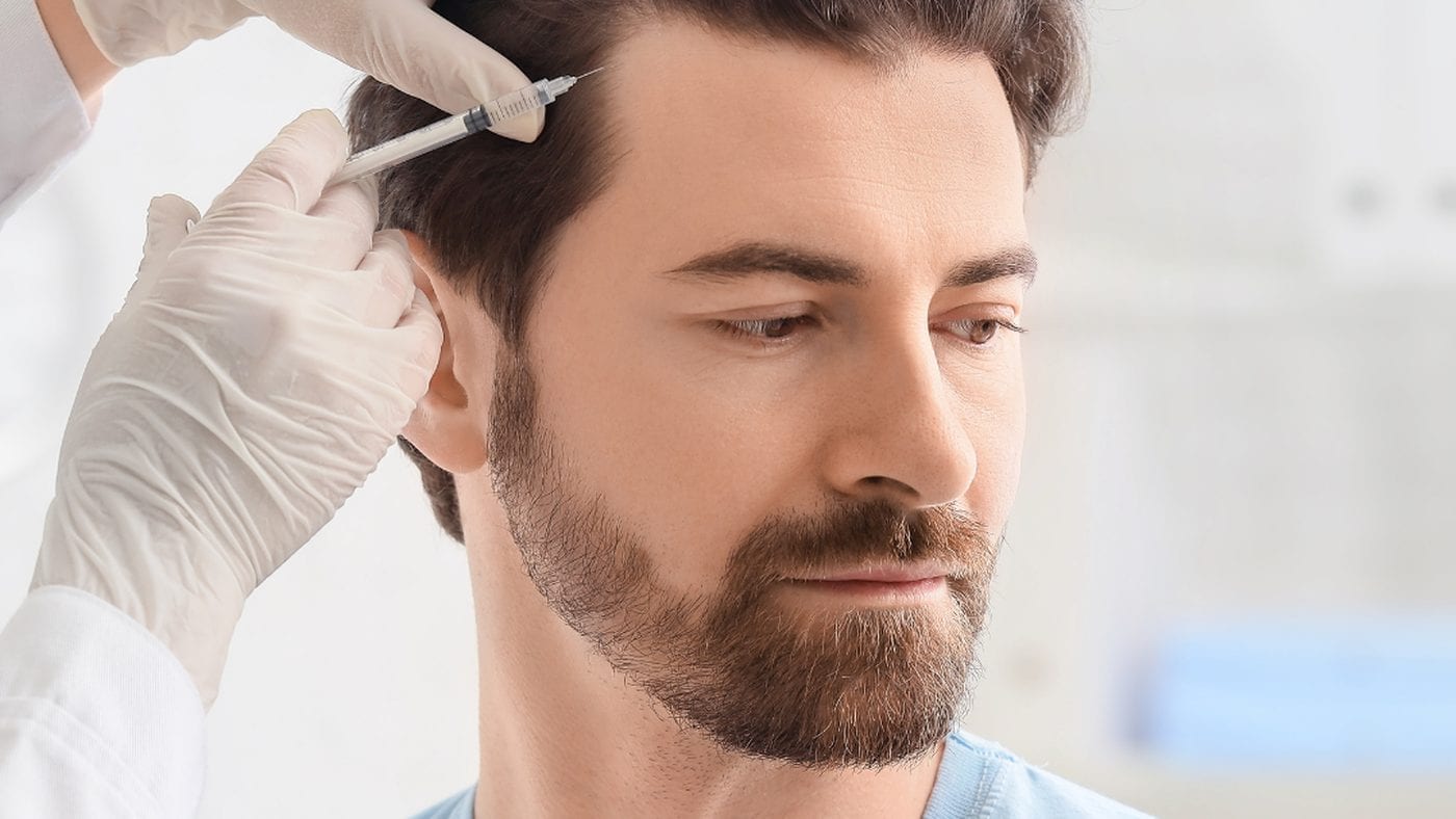 How to reduce and slow hair loss (non-surgical methods)
