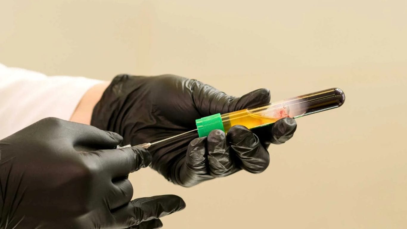 Gloved hands holding a centrifuged blood tube, with the separated plasma layer visible above the red cells.