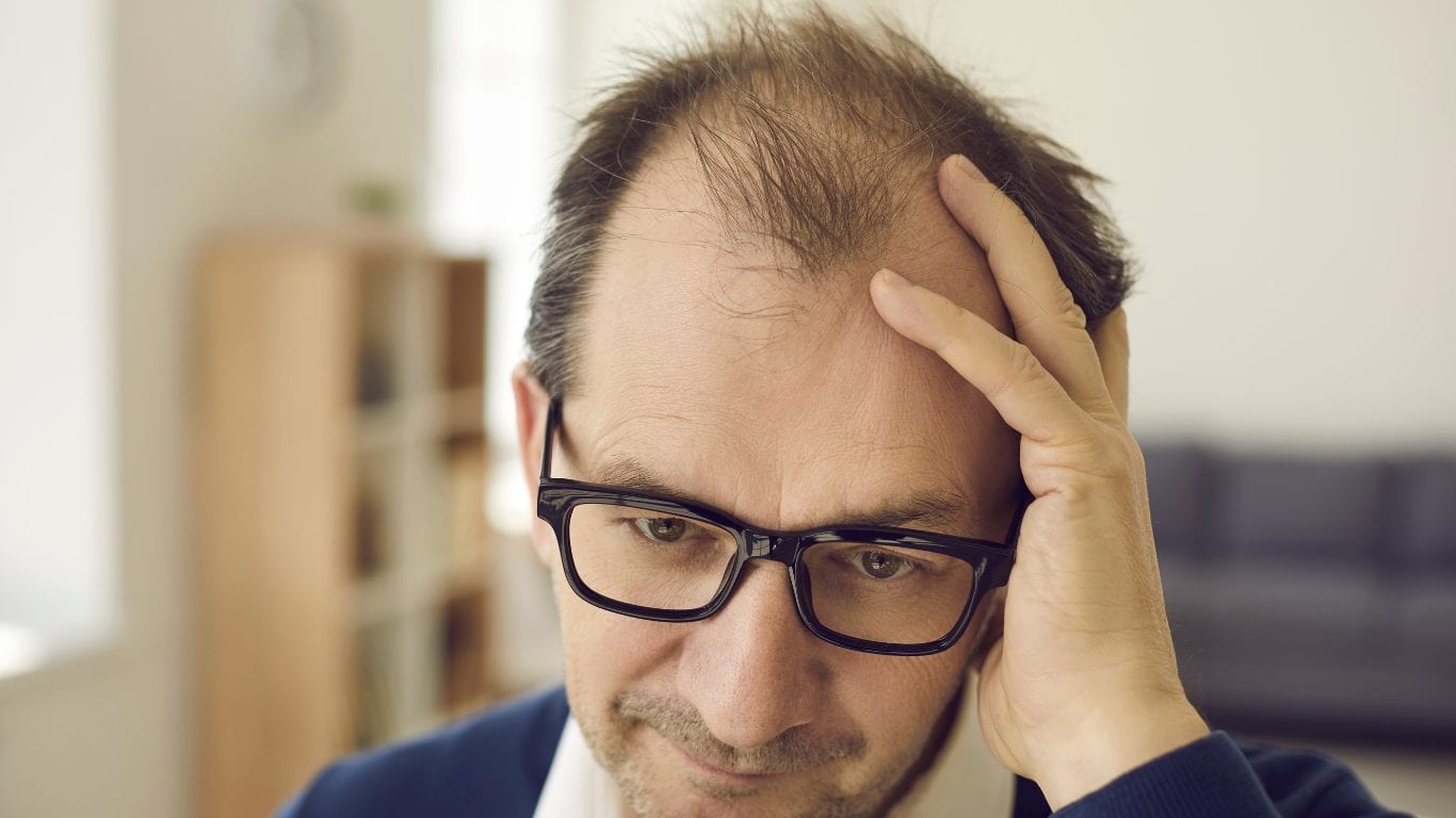 Ein Mann mit Brille stützt eine Hand an den Kopf, mit zurückgewichener Haarlinie und ausgedünntem Haar vorn.