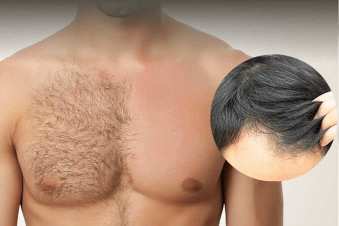 Body hair characteristics: growth cycle and calibre differences