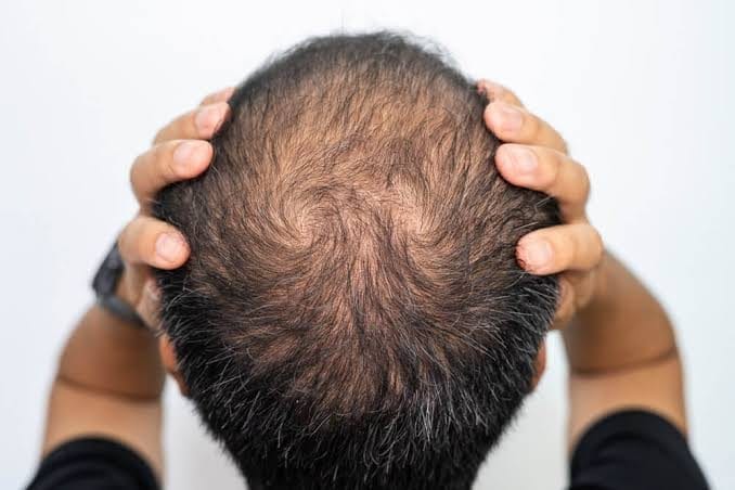 لماذا يصعب استعادة التاج