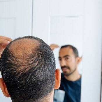 Donortäthet och hur den begränsar graftantalet