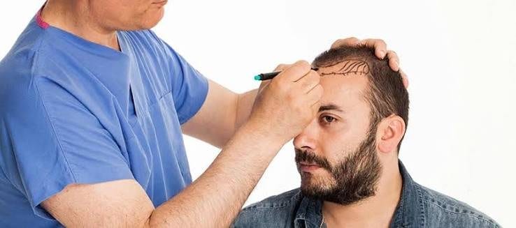 الجلسات الكبرى: مخاطر وفوائد 3000 طعم فأكثر