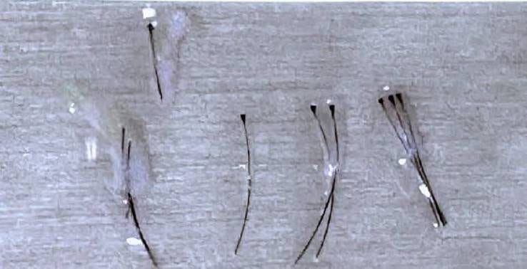 Prozentzahlen zum Anwachsen der Grafts in Langzeitstudien