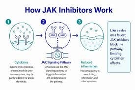 JAK-hæmmere: den nyeste mulighed mod alopecia areata